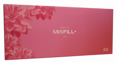 Misfill Deep